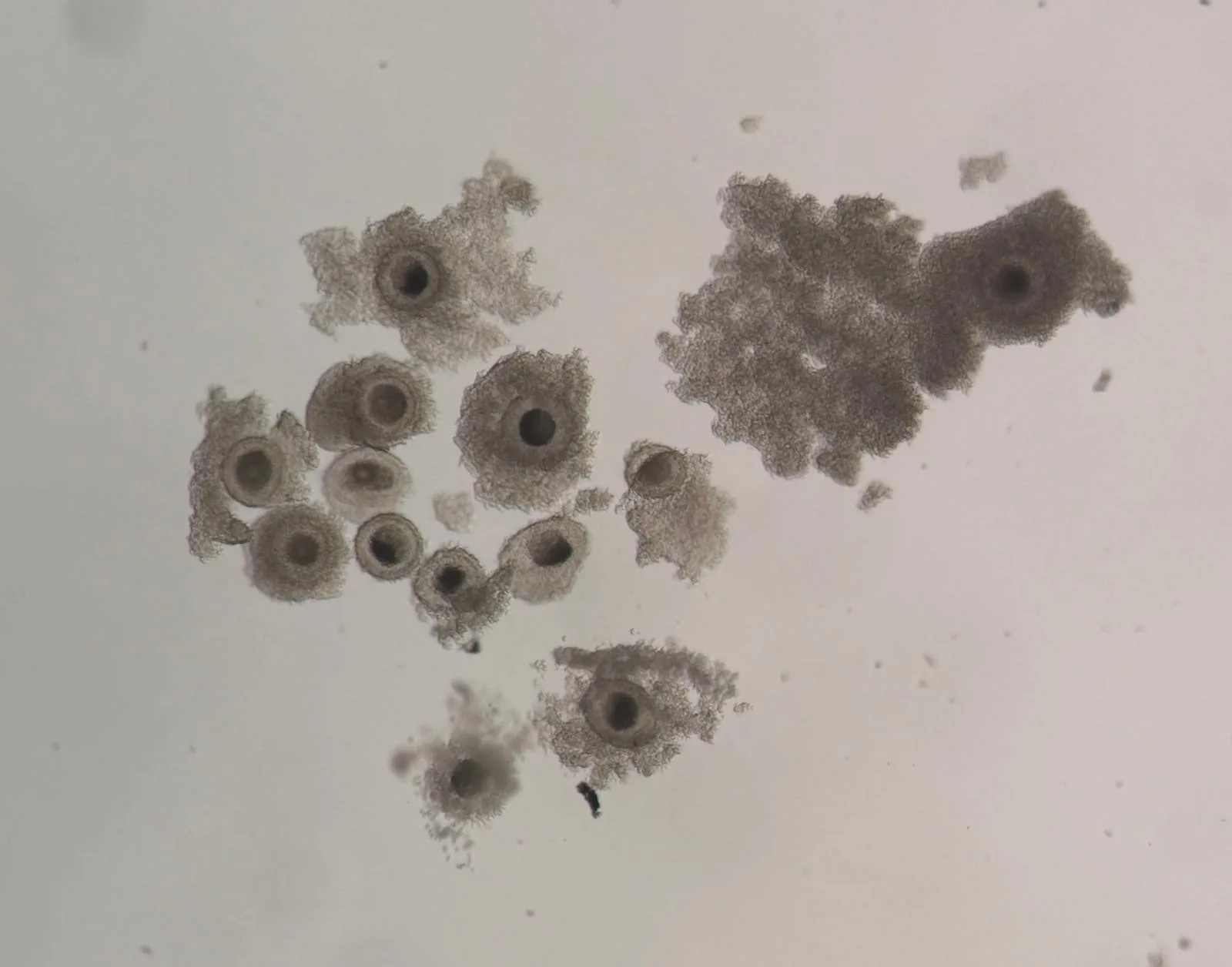 Cumulus-oocyte complexes recovered from the ovary, each oocyte still surrounded by its cumulus cells.