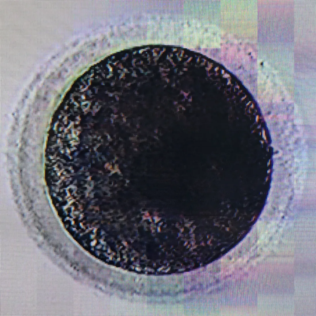 A single oocyte under the microscope. Development is monitored closely through the days that follow fertilization.