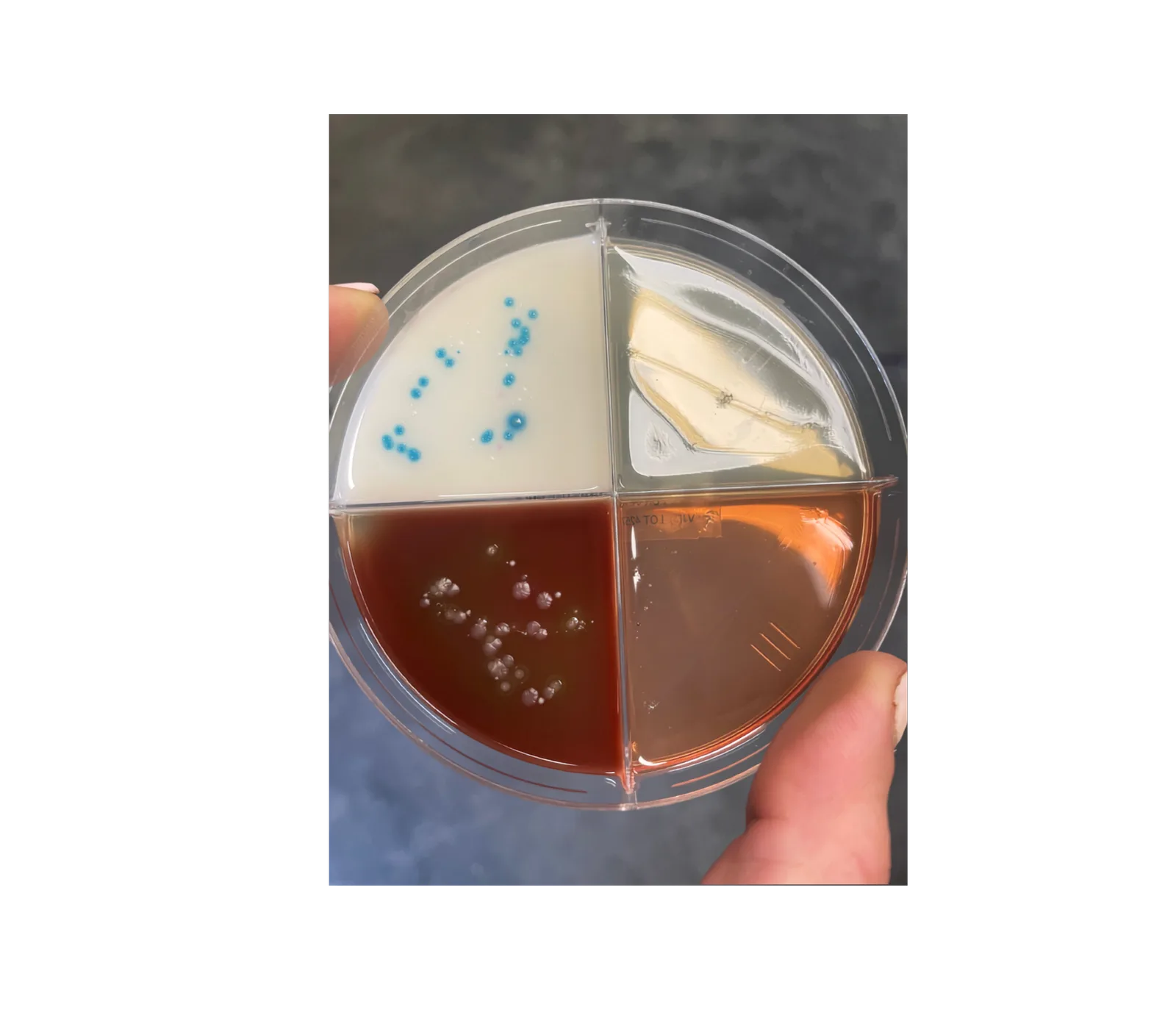 A quad culture plate from a mare's uterine swab — a culture and cytology can catch infection before you commit a stud fee.