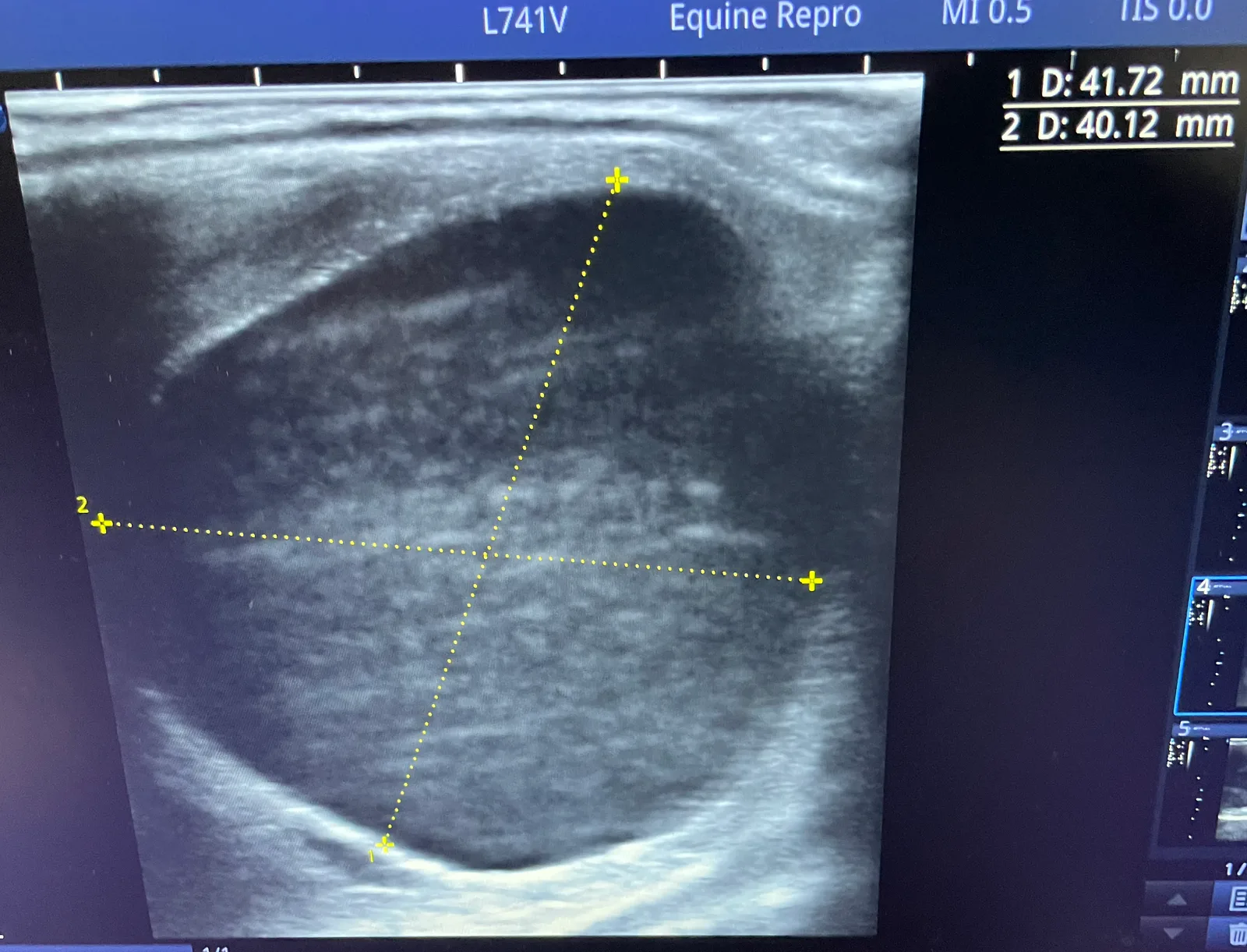 A large follicle coupled with edema in the uterus indicates the mare is in heat.